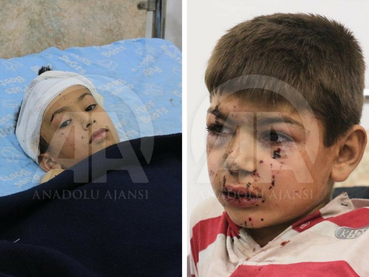 В Дамаске обстреляна школа: погибли и ранены дети – ФОТО - ВИДЕО