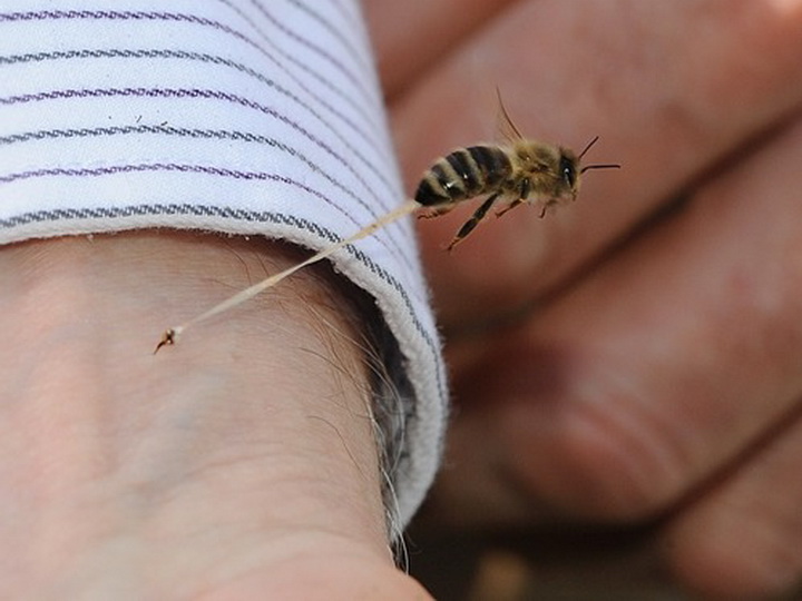 Житель Баку скончался после укуса пчелы