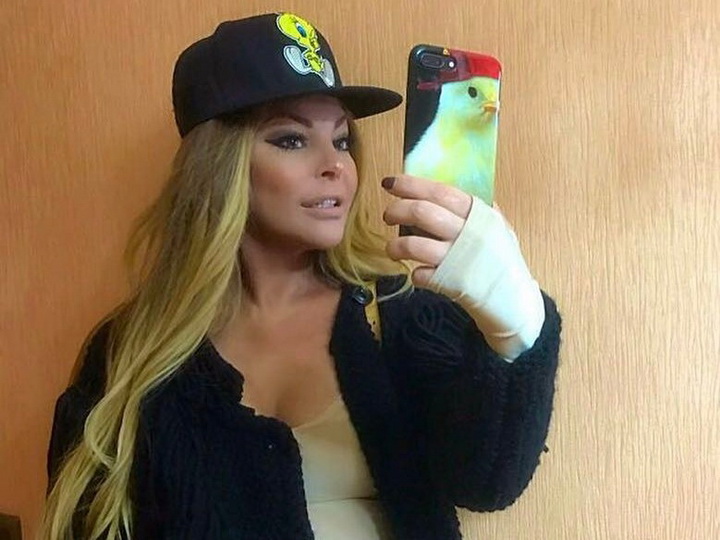 Айгюн Кязимова показала, как она выглядит после трех пластических операций – ФОТО