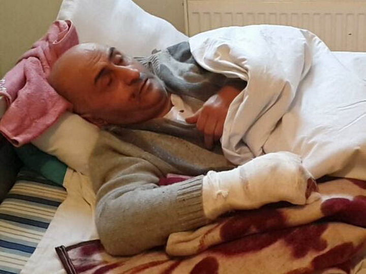 Несчастный случай: Жителю Сумгайыта ампутировали пальцы из-за пиротехники – ФОТО