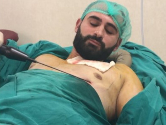 В Азербайджане хирург прооперировал сам себя – ФОТО - ВИДЕО