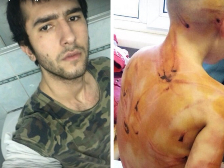 20-летний отчим, жестоко избивавший 4-летнюю падчерицу за неумение считать до пяти, оказался азербайджанцем – ФОТО – ВИДЕО