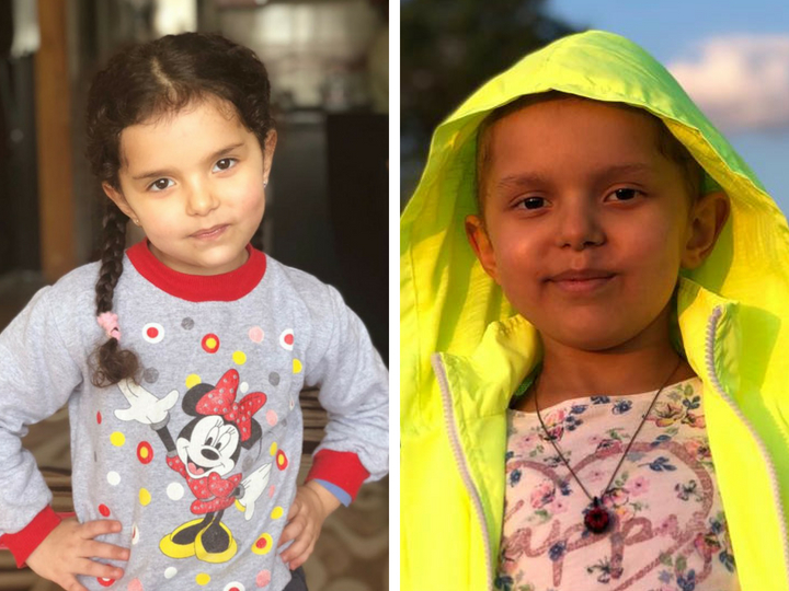 День рождения между сеансами химиотерапии: маленькой Шамс исполняется всего шесть, и она очень хочет жить - ФОТО