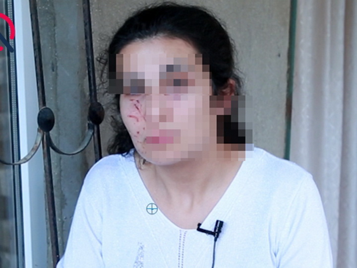 Полиция Баку о том, что сексуальный маньяк, напавший на женщину, разгуливает на свободе – ФОТО - ВИДЕО - ОБНОВЛЕНО