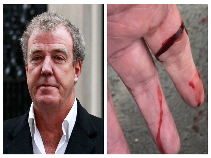 Звезда Top Gear Джереми Кларксон получил травму на съемках в Баку – ВИДЕО