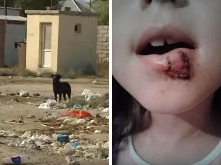 В Баку собаки напали на детей – ВИДЕО