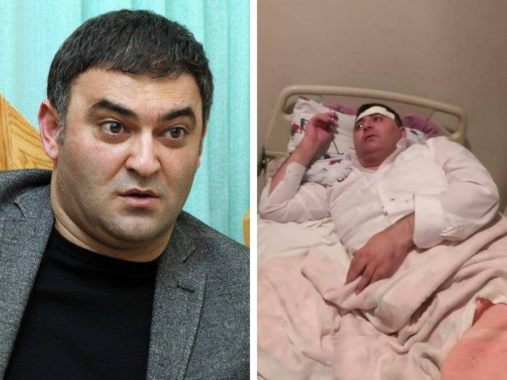 Управление образования Баку об избиении директора школы – ФОТО - ВИДЕО