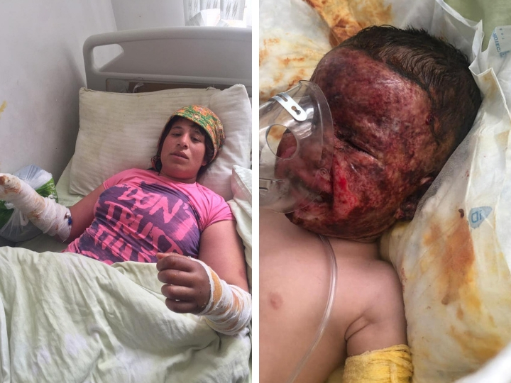 Маленькая Анжела пострадала при пожаре в доме. Надежда на ее спасение есть. Нужна ваша помощь! - ФОТО - ВИДЕО