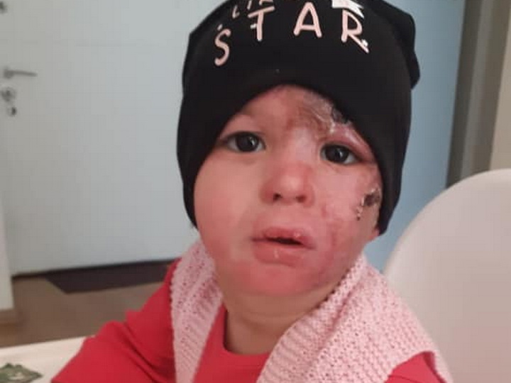 Новости о маленькой Анжеле: началась реабилитация – ФОТО