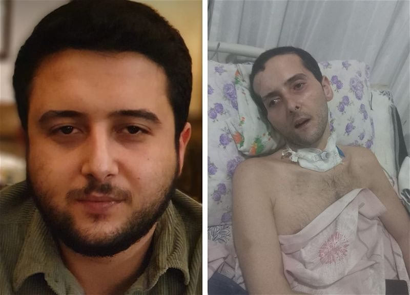 «Я верю, что мой сын снова встанет на ноги»: мать 30-летнего Кямиля просит помощи для срочной операции - ФОТО - ВИДЕО