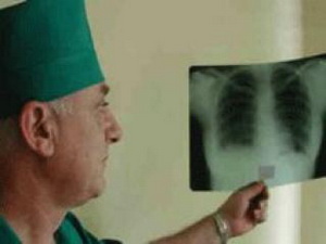 В Азербайджане увеличилось число выявленных больных туберкулезом