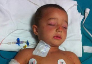 Лечение мальчика, пострадавшего в аквапарке Nabran Holiday Village, взято под контроль Президента Азербайджана - ДОПОЛНЕНО