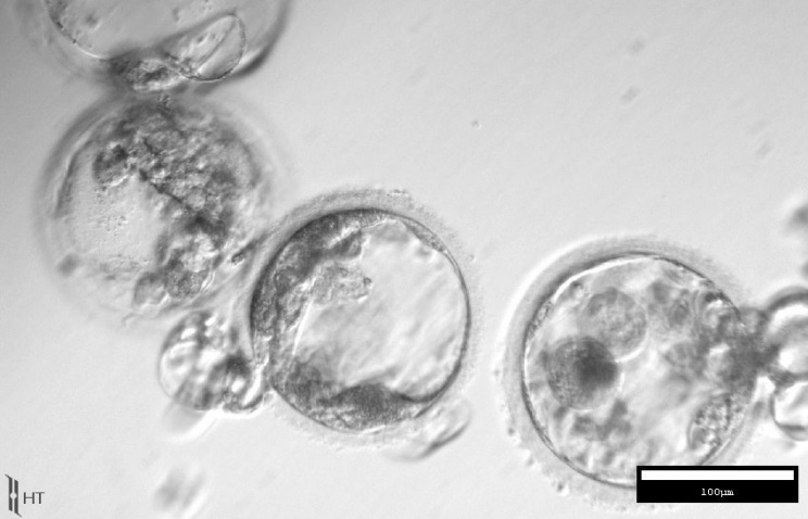Ученым удалось клонировать стволовые клетки из тканей взрослого человека