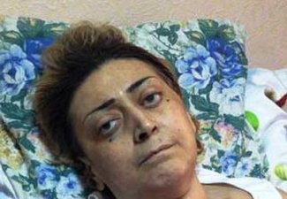Ханым Гафарова: «Мехрибан ханум Алиева поручила оплатить мое лечение, слава Богу, моя дочь не останется сиротой…»