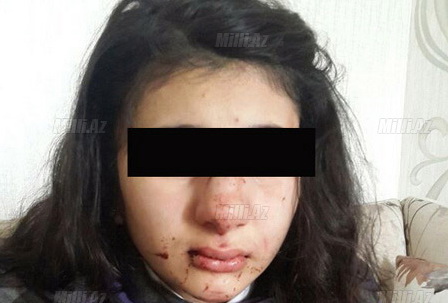 В Баку задержан мужчина, жестоко избивший школьницу – ФОТО - ВИДЕО