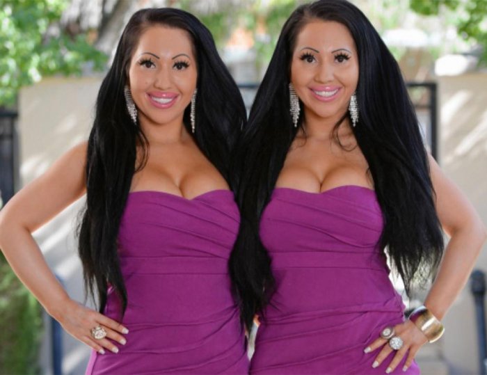 Самые одинаковые близнецы в мире потратили 250 тысяч долларов на пластику - ФОТО