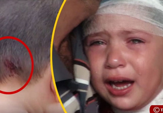 Трехлетняя девочка, раненная в голову в результате армянского обстрела, намерена отомстить врагу - ВИДЕО