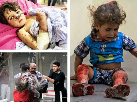 Израненные войной. Алеппо тонет в крови невинных детей – ФОТО - ВИДЕО