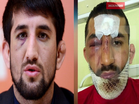 Нападение на спортсмена Мирзаева может быть связано с предстоящим поединком