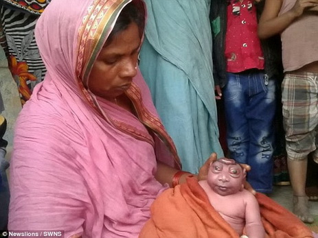 В Индии родился необычный ребенок, которого считают реинкарнацией божества Ханумана – ФОТО
