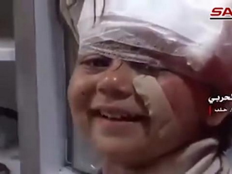 «Солнце взойдет»: Видео маленькой сирийки, улыбающейся, превозмогая боль, вызвало большой резонанс в Сети - ВИДЕО