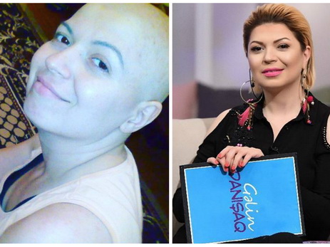 Актриса Зюмрюд Гасымова, победившая рак: «Мне хотелось перемотать мою жизнь, словно пленку …» - ФОТО – ВИДЕО