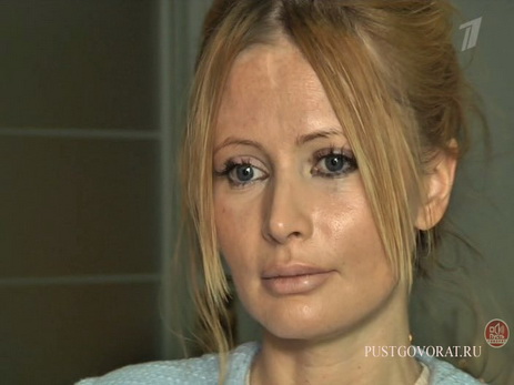 Как сейчас выглядит Дана Борисова, проходящая лечение в наркологической клинике – ФОТО