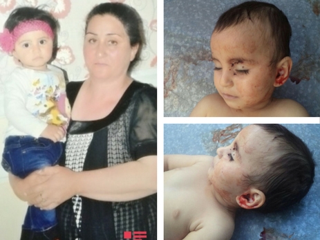 Хиджран Гусейнова: Сколько еще детей должно погибнуть в Азербайджане, чтобы мир осудил агрессию Армении?