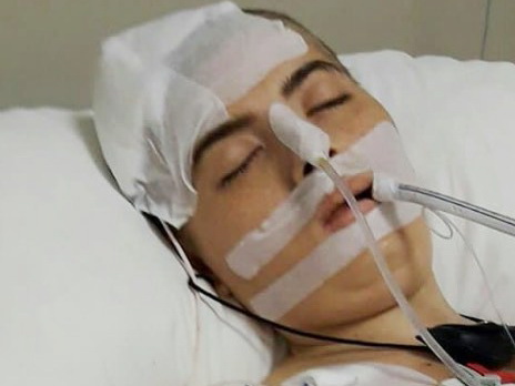 Органы умершей в Турции азербайджанской актрисы будут использованы для донорства – ФОТО