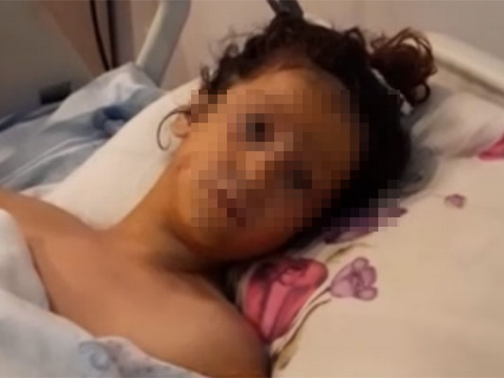 В Баку ребенку, забравшемуся во время игры в трансформаторную будку, ампутировали руку - ФОТО